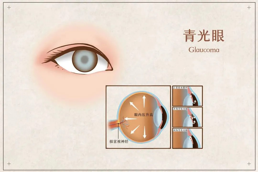 640.webp 640.webp